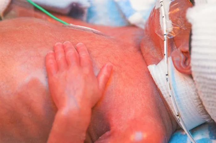Premature baby