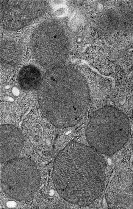 AKI mitochondria