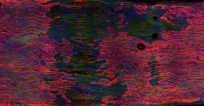 Blood vessel lining