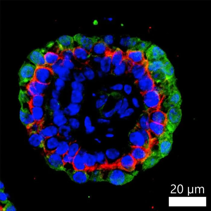 Tumor organoid