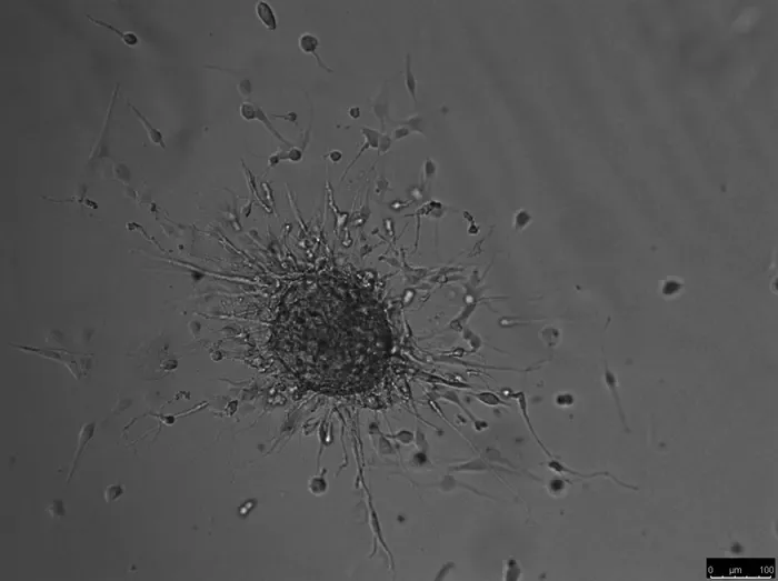 Glioblastoma cells