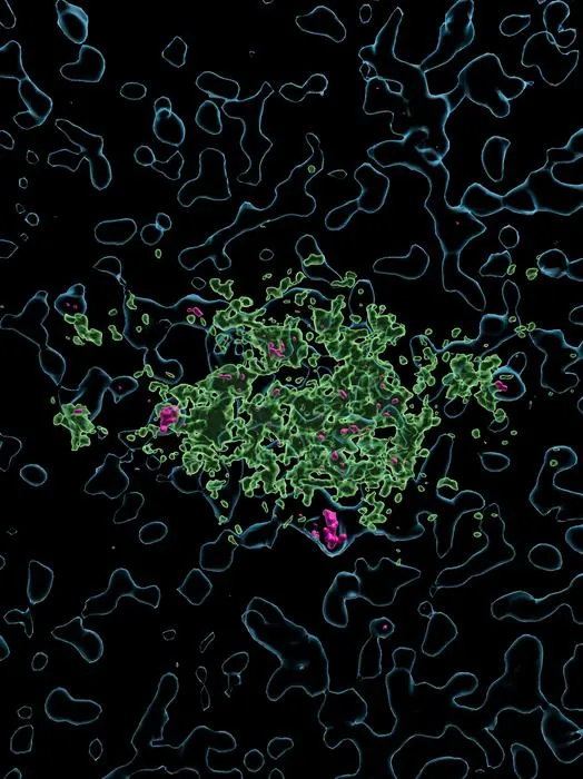 An Imaris reconstruction illustrating Lecanemab taken up by human microglia