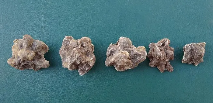 Fossil anaconda vertebrae, which make up the backbone