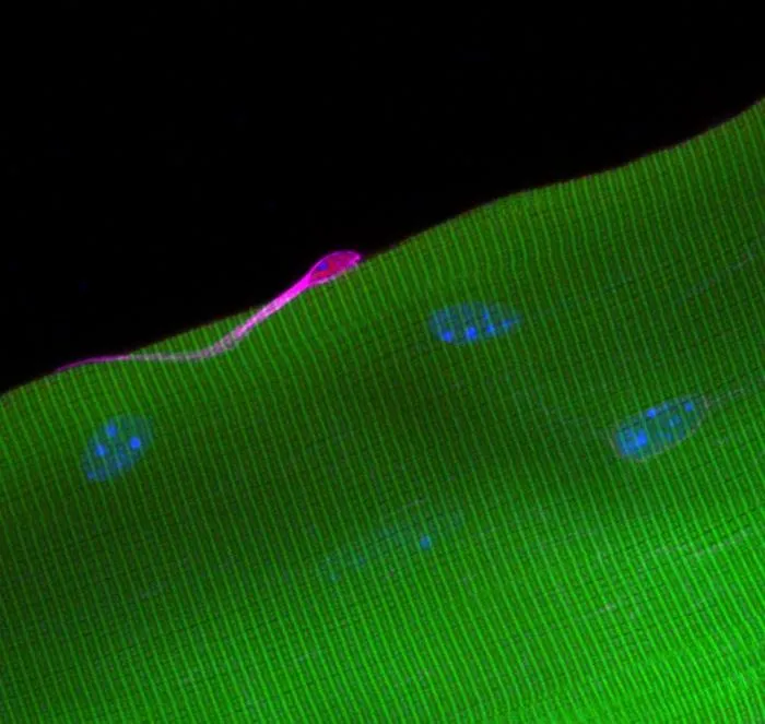 Muscle stem cell