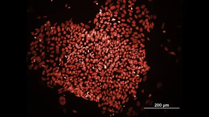 iPSCs
