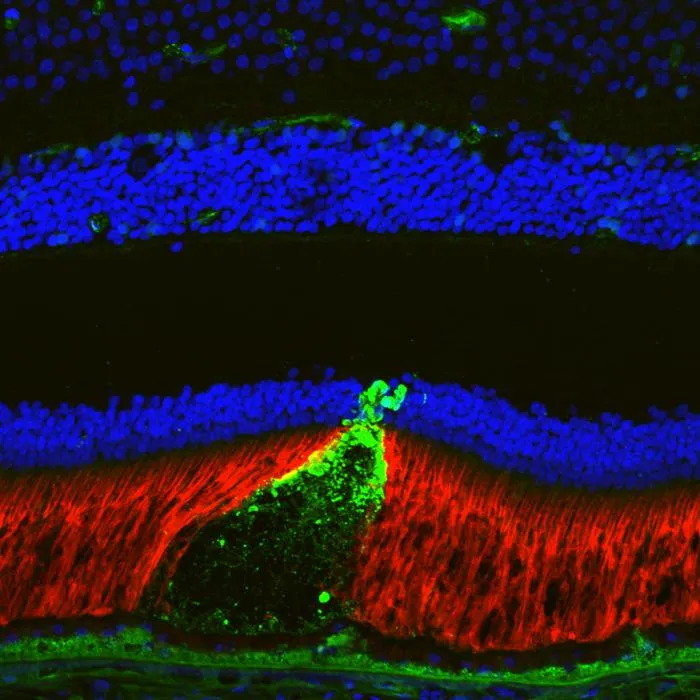 Retina image