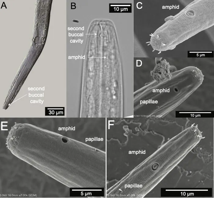 D. woaabi microscopic
