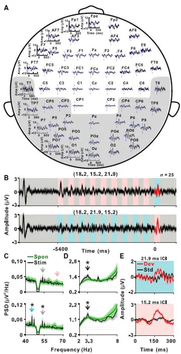 Fig. 4. Electrophysiological responses to the click-train-based oddball paradigm in human.