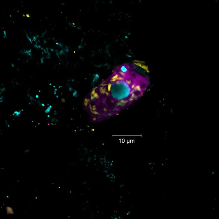 The endosymbiont Candidatus Azoamicus mariagerensis and its ciliate host under the fluorescence microscope.