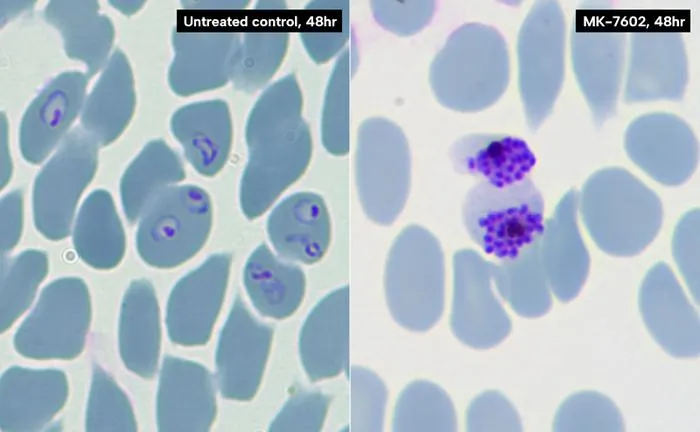 MK7602 Efficacy