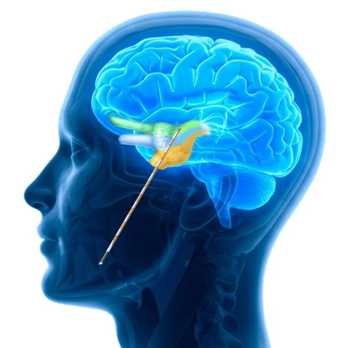 NeuroOne