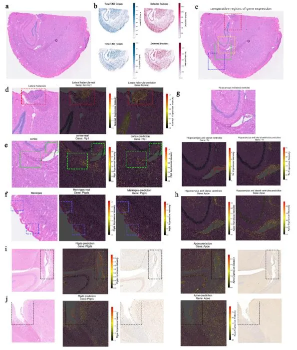Fig 2 Spatial gene expression (real vs predicted) Validation of gene pattern accuracy