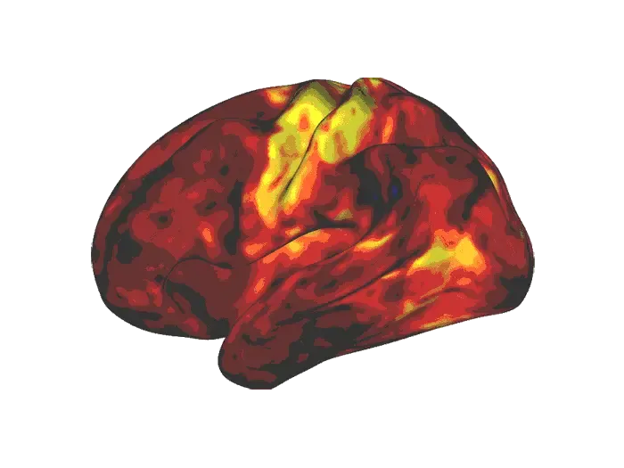 Brain on stimulant ADHD medication