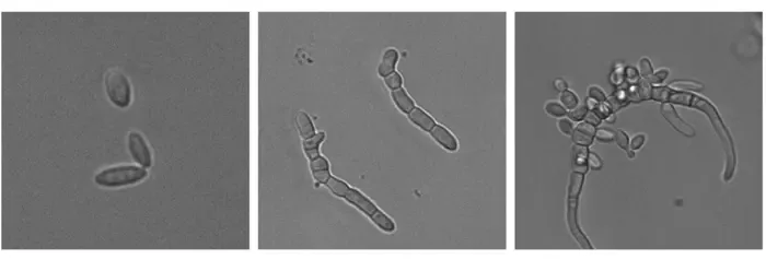 Marine yeast Horatia werneckii switches between single-celled and multicellular forms