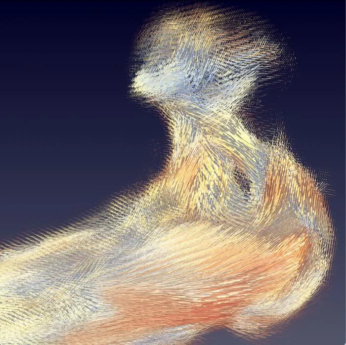 local collagen structures in an ossicle
