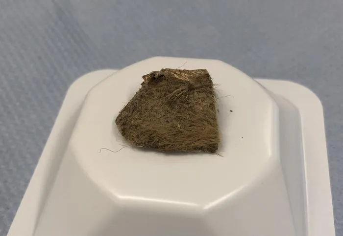 Woolly rhino tissue from stomach