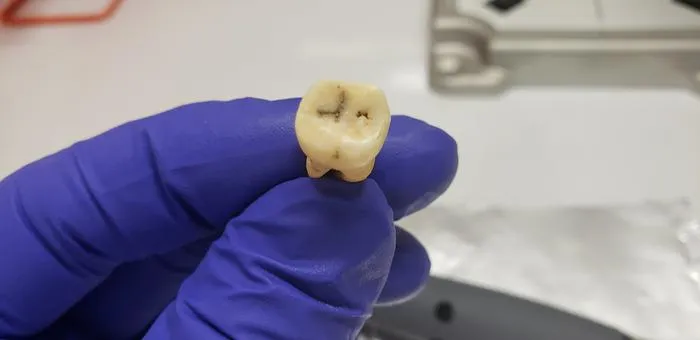 Jerash tooth 2 - May 2022 - Credit Greg O'Corry Crowe FAU