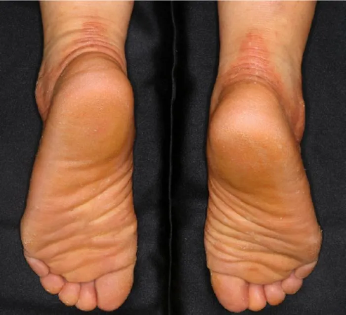 20260122_Kubo_Feet