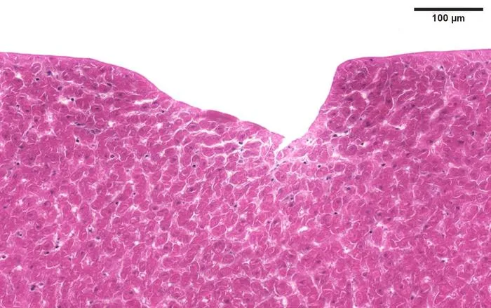 Non optimised ablation