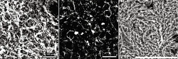 SGLT2 inhibitors maintain youthful capillaries