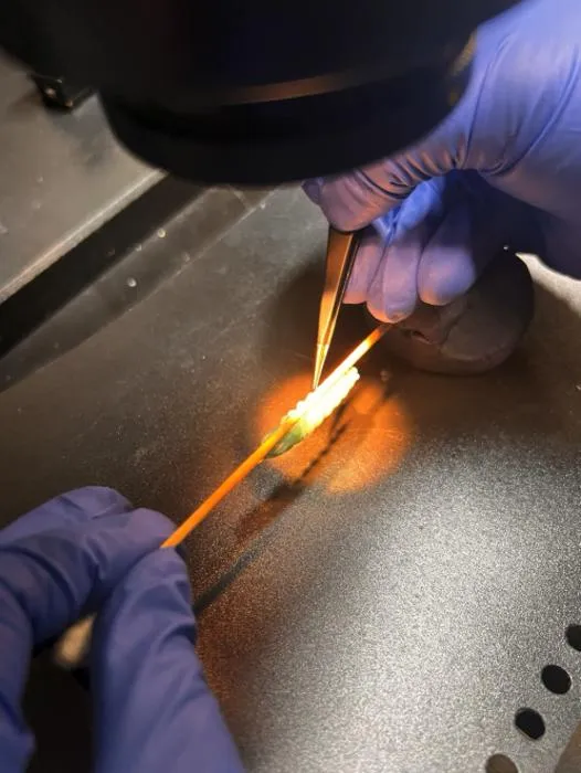 Ablation