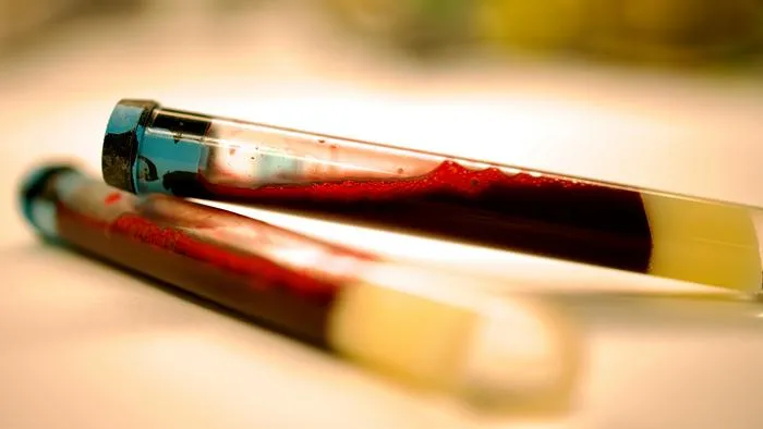 Early signs of Parkinson’s can be identified in the blood