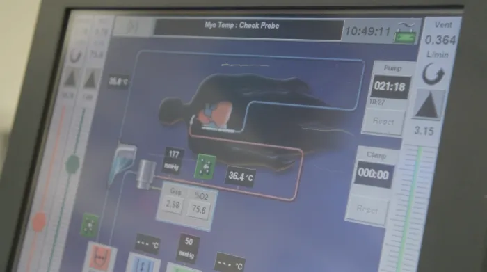 A monitoring screen that tracks blood flow, oxygen levels, and temperature.