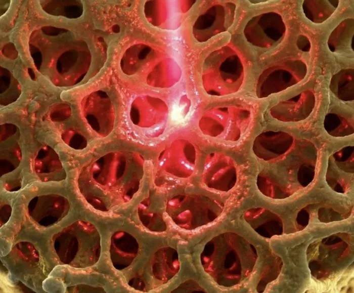 Nanoporous gold