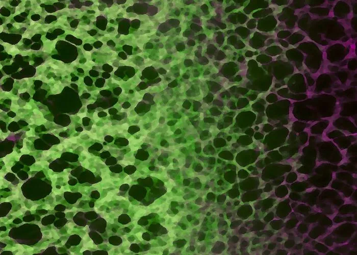 ER Phagy