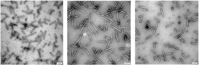 Transmission electron microscope image showing human cells to which engineered eCIS (red arrows) bind using their tail fibers prior to protein injection.