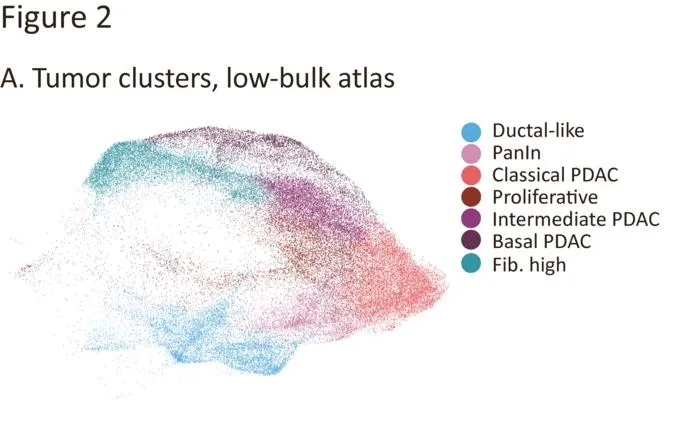 Characterization of the tumor compartment of the PDAC tissue