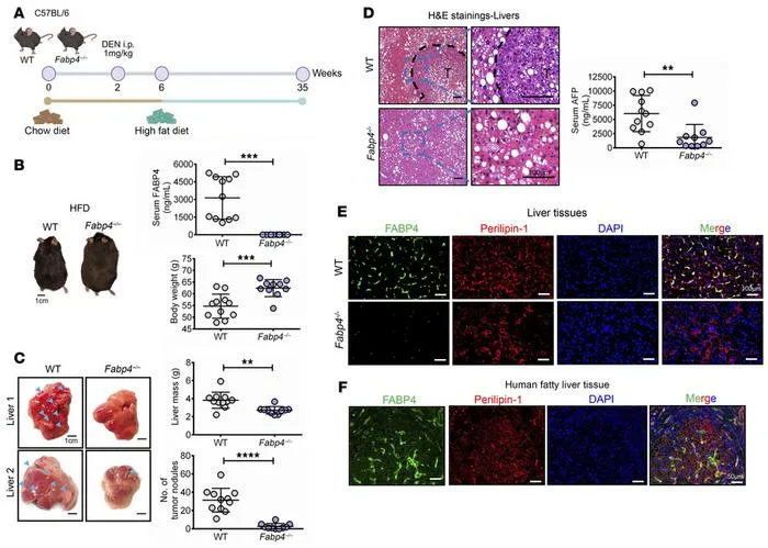 PolyU develops novel antibody targeting fat cell protein, offering new approach to treating metabolism-related liver cancer