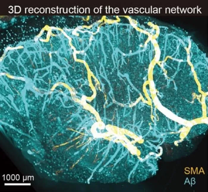 3D reconstruction of the vascular network.
