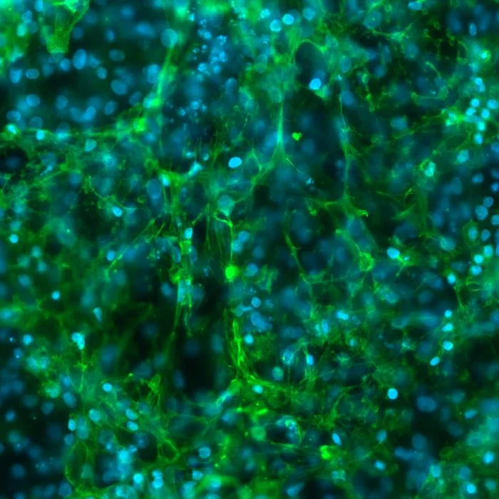 Heart cells