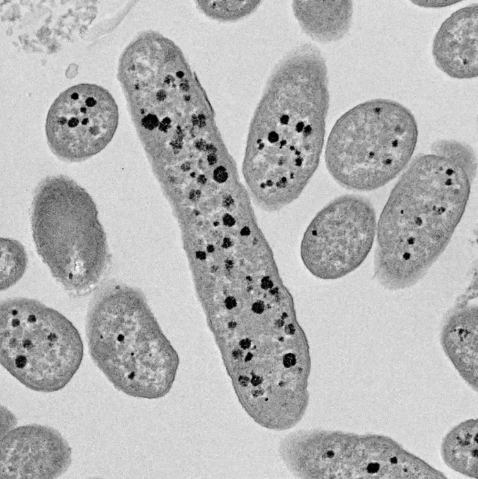 Bacteroides thetaiotaomicron removes protective sulfate groups from mucin