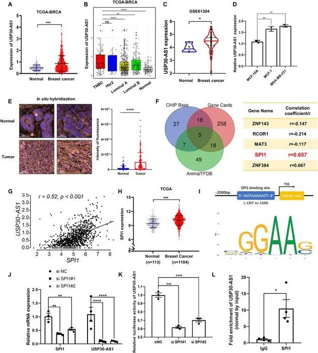 USP30-AS1 is notably up-regulated in breast cancer tissues.