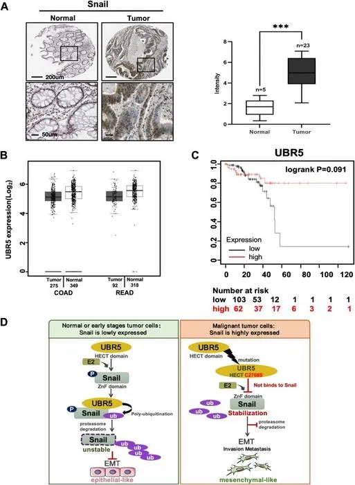 UBR5 was a favorable prognostic factor in human colorectal cancer.