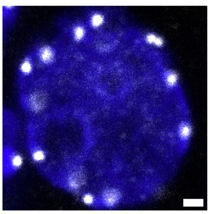Centromeres at nuclear periphery