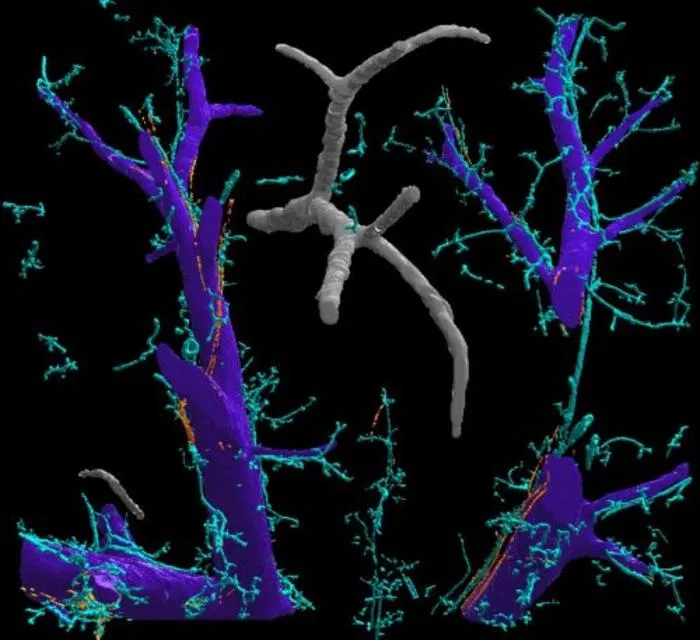 Reconstruction of liver veins