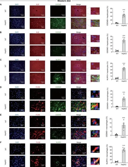 Pyroptosis occurs primarily in hepatocytes and inflammasomes are formed predominantly in macrophages in the liver of Atg14 HepKO mice.