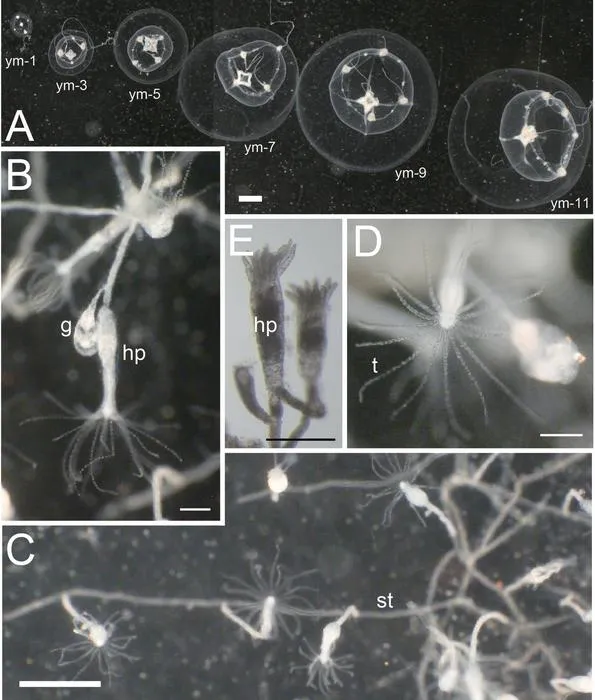 Polyps and juvenile–young medusae of Malagazzia michelin