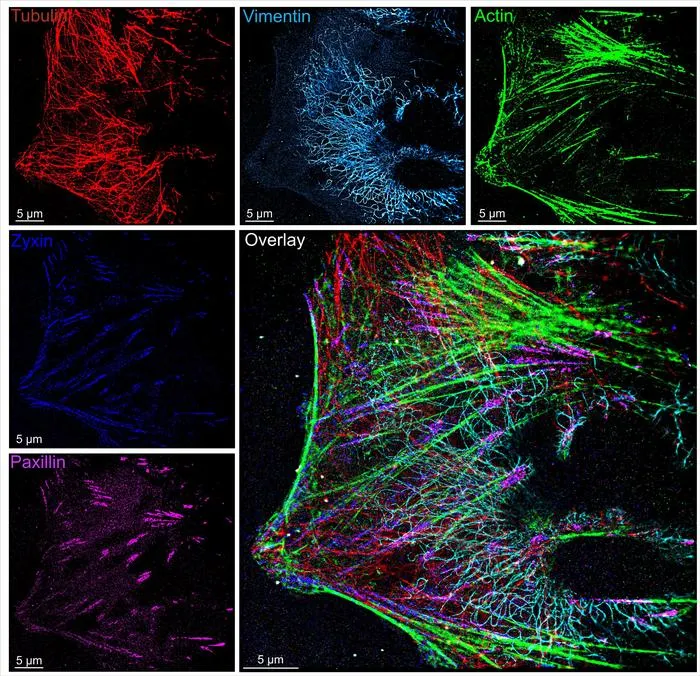 Super-resolution image of cytoskeleton and focal adhesion proteins taken using the new versatile and cost-effective microfluidics system. The “overlay” of all the different target molecules reveals exquisite and complex detail up to 100 times sharper