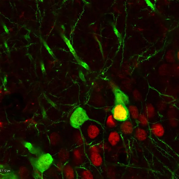 Hippocampus neurons