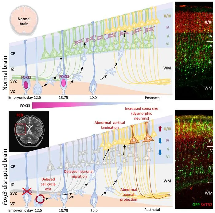 FOXJ3 is essential for proper cell fate determination and cortical lamination in deeper-layer and Layer 4 neurons.