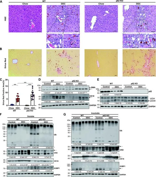 Hepatic p62 is dispensable for DDC-diet induced cholestatic injury, fibrosis and hepatocytic MDB formation.