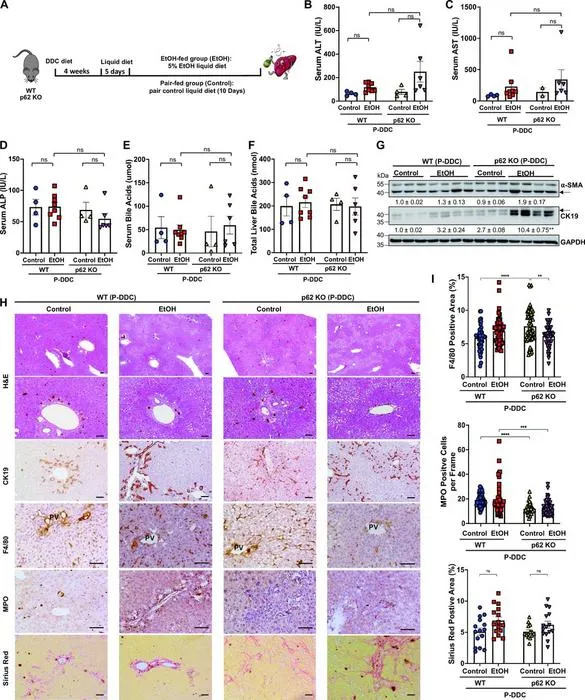 Loss of p62 does not affect the recovery of liver injury and MDBs after withdrawal of DDC diet.