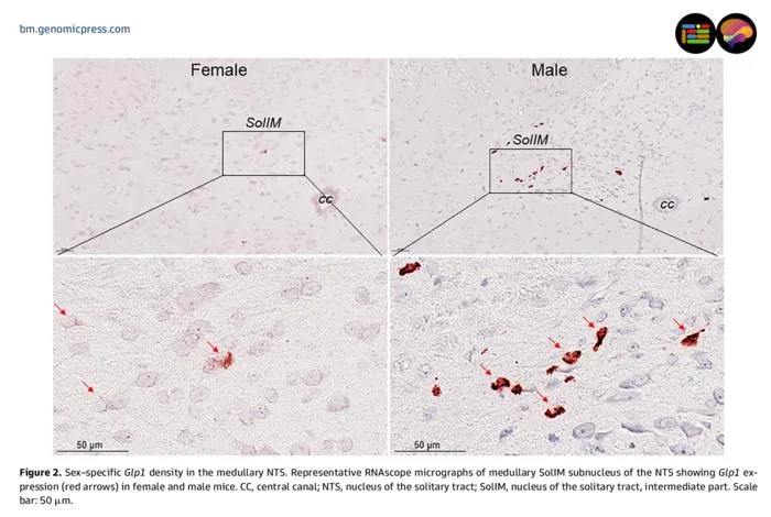 Sex–specific Glp1 density in the medullary nucleus of the solitary tract (NTS).