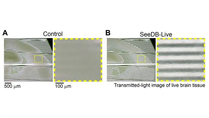 Transmitted-light images of live mouse brain slices with and without SeeDB-Live optical clearing