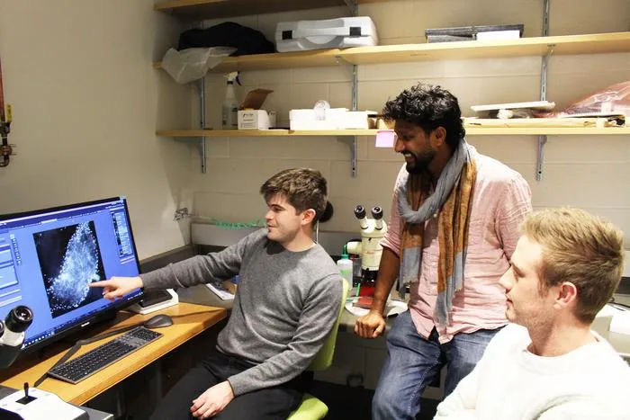 Viewing seminal vesicles