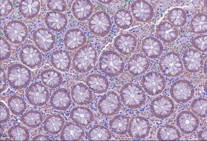 Cell detection with LazySlide